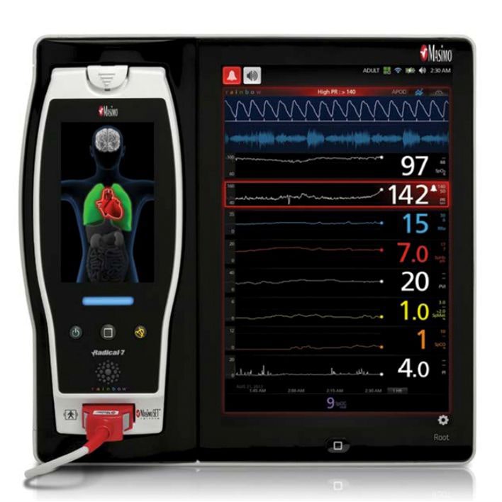 Masimo Root Monitor with Trend View