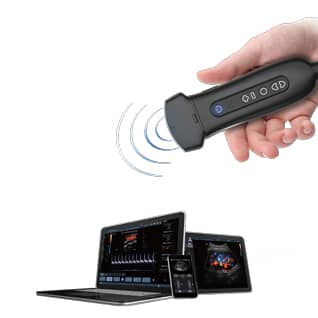 MDPro Soloscan P50 Portable Diagnostic Ultrasound On Screen Display