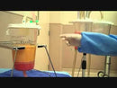 MD AquaVage Canister System video