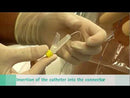 How to use B. Braun's Perifix FX Springwound Epidural Catheter and Espocan CSE Needle System