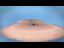 How IontoPatch Works