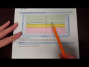 BeamMed Sunlight MiniOmni Ultrasound Bone Sonometer