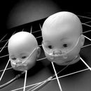 Salter Labs Tender Grip Newborn Skin Fixation System In Use