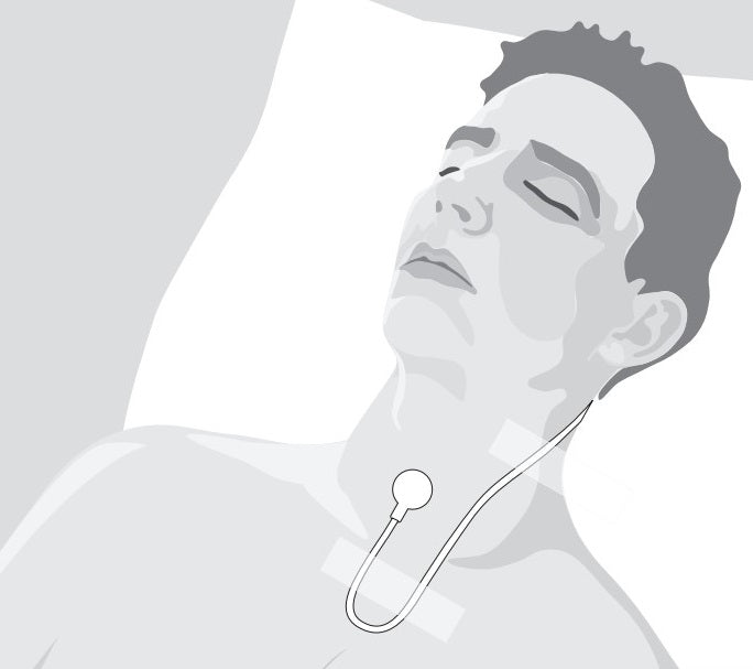 SleepSense Piezo Snore Sensor - Alice 5
