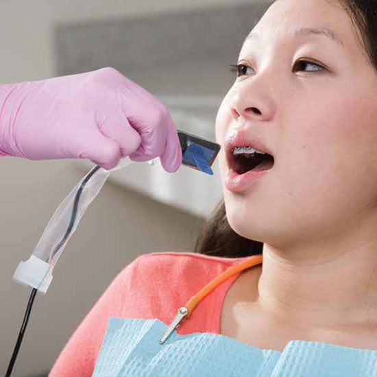 TIDI TIDIShield Digital X-Ray Sensor Sheath Covers (500/Case) 