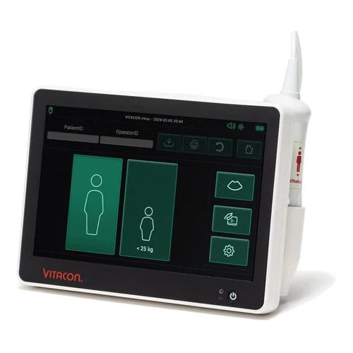 Vitacon VitaScan eVue Bladder Scanner