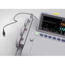Wallach Fetal2EMR Insight Connection Cable