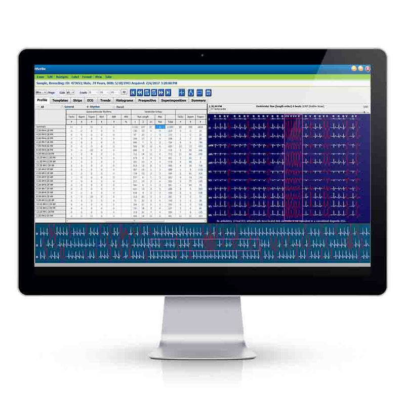 Welch Allyn HScribe Holter Analysis System  Software with DICOM, Monitor, Printer