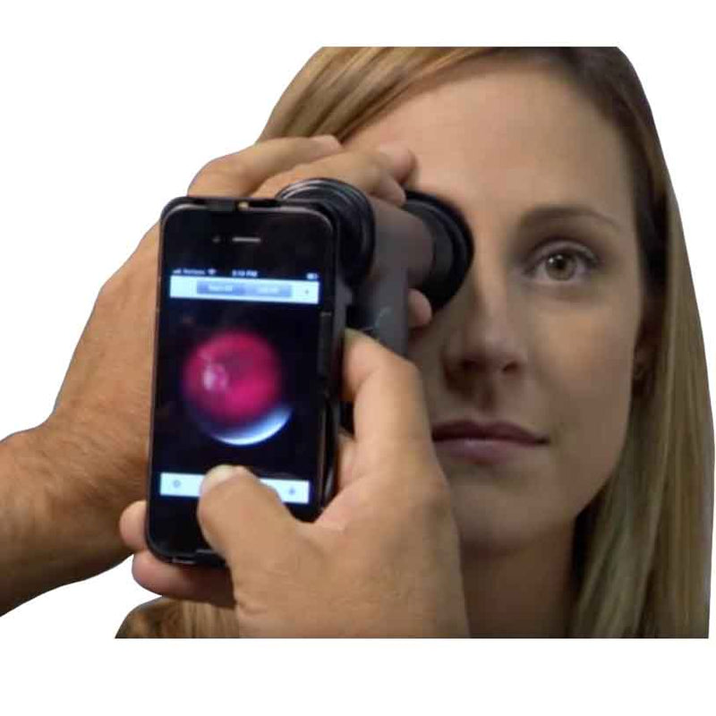 Welch Allyn iExaminer Phone Adapter 