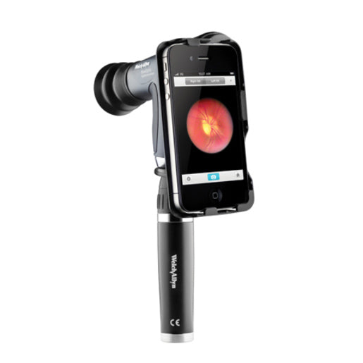 Welch Allyn iExaminer Phone Adapter  iPhone 6 Plus; iPhone 6s Plus
