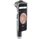 Welch Allyn MacroView Plus LED Otoscope with iExaminer