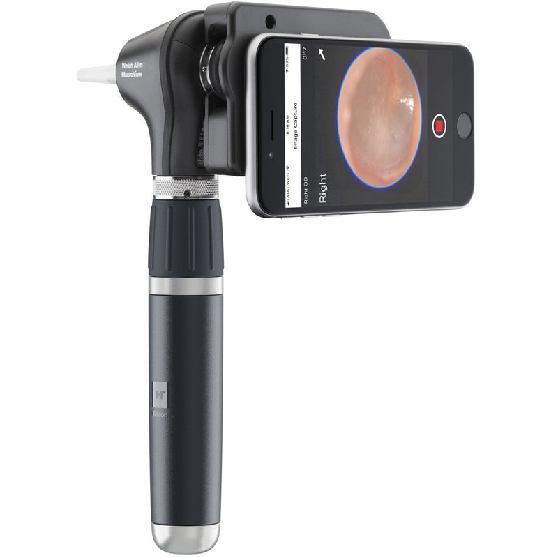 Welch Allyn MacroView Plus LED Otoscope - 238-3