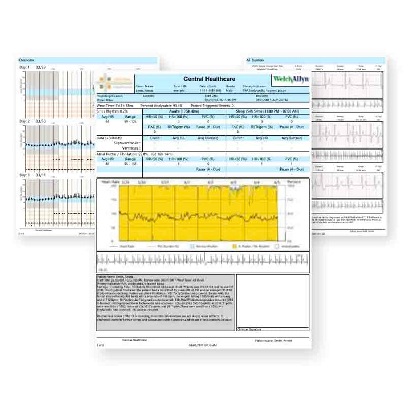 Welch Allyn TAGconnect Software
