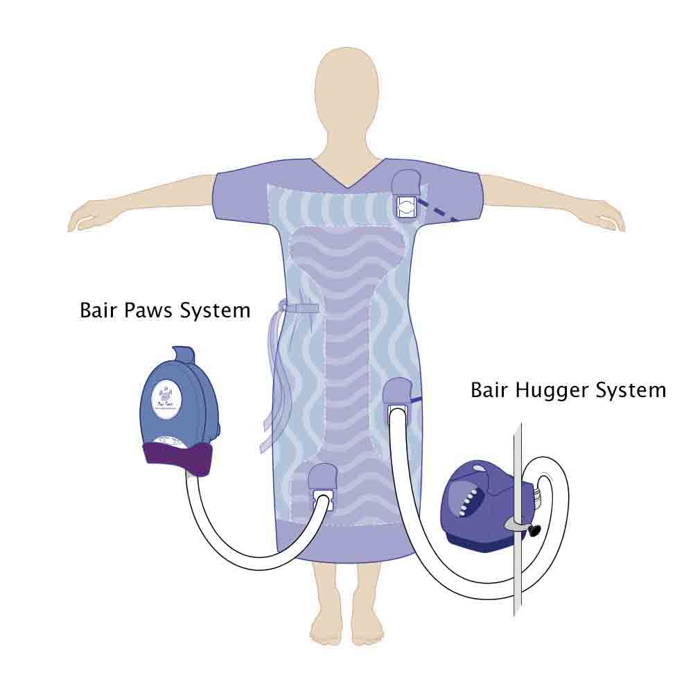 3M Bair Paws Plus Patient Warming Gown