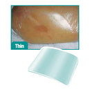 3M Tegaderm Hydrocolloid Square Dressing