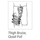 Chattanooga Sully Hip S'port - Thigh Bruise and Quad Pull Demo
