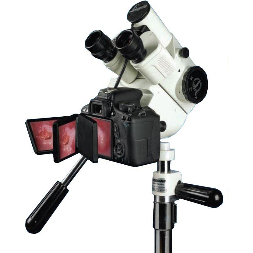 Leisegang OptiK Model 2 CCD Photo/Video Colposcope with Canon Camera