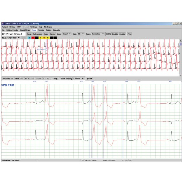 QRS Holter LX Analysis Software