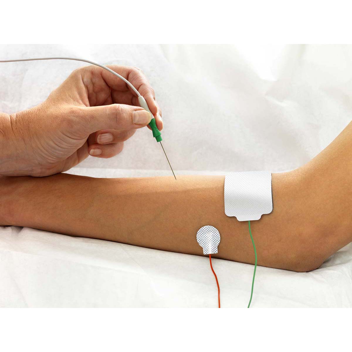 Technomed Disposable Concentric EMG Needle Electrode in use