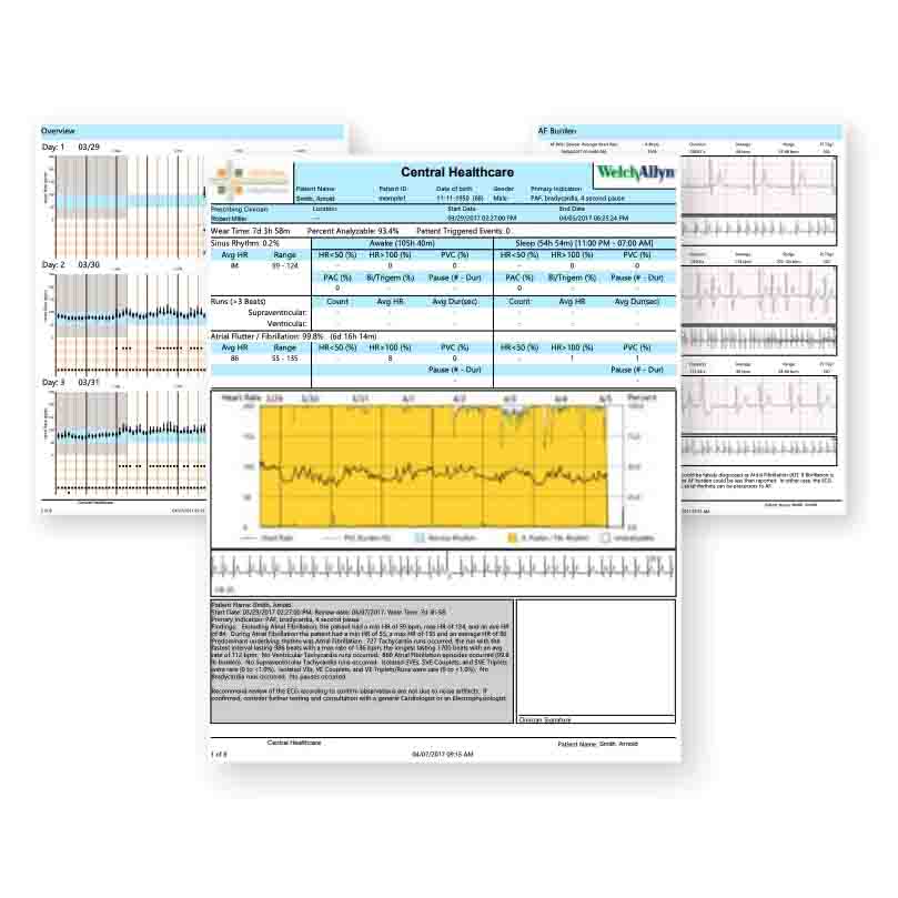 Welch Allyn TAGconnect Software